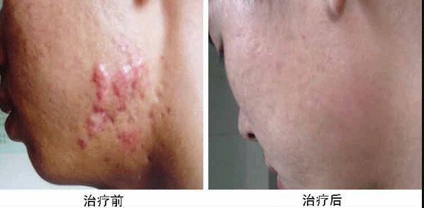 合肥哪家整容醫(yī)院雙眼皮做得好？專業(yè)整形外科專家推薦