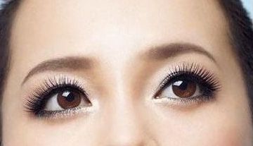 成都嬌點王運平隆胸效果如何？真實案例分享！