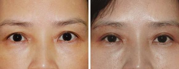 上海激光美容醫(yī)院排名及熱門選擇，哪家好？