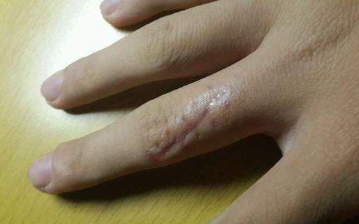 上海哪家醫(yī)院做肋骨鼻子整形手術好？