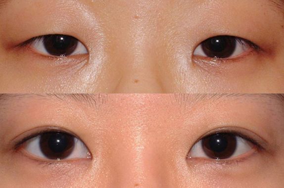 蘇州打瘦臉針哪家醫(yī)院好？2023年蘇州瘦臉針治療排行榜發(fā)布