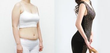 成都做雙眼皮，哪家醫(yī)院專業(yè)可靠？