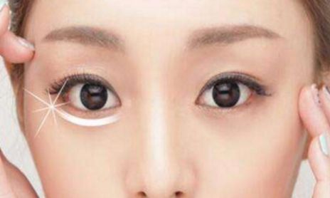 荊州割眼袋哪家醫(yī)院好？眼袋修復(fù)專家為您推薦！