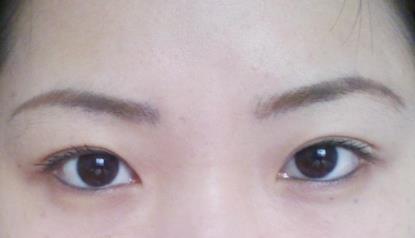 上海九院李青峰隆鼻價(jià)格高昂還是平價(jià)？你知道嗎？