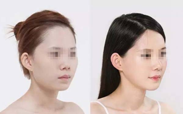 北京隆胸醫(yī)生排行：網(wǎng)友推薦的實力派、口碑出眾的美容專家值得關(guān)注
