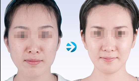蘇州哪家吸脂好又實惠？專業(yè)美容機(jī)構(gòu)為您推薦