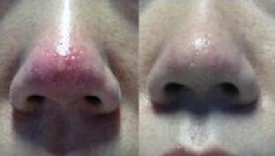 福州哪家醫(yī)生做隆胸技術(shù)好？推薦五位專業(yè)醫(yī)師，價格參考！