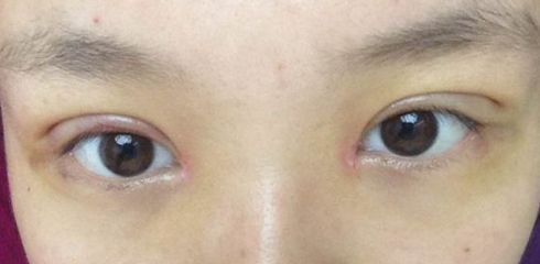 徐州做拉皮哪家醫(yī)院好？一起來看看徐州市最受歡迎的做拉皮醫(yī)院