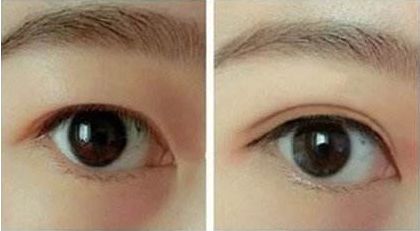 合肥哪家整形醫(yī)院好口碑好服務(wù)好值得推薦？