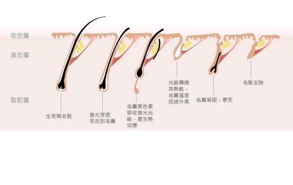 深圳哪家激光祛斑醫(yī)院口碑好？