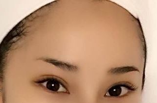 上海醫(yī)院最好治療皮膚疤痕的專科是哪家？