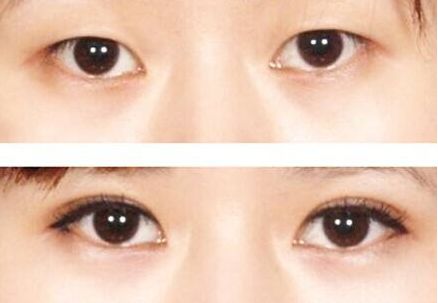 榆林市美容哪家醫(yī)院好？榆林市頂級美容醫(yī)院推薦