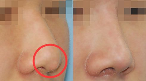 福州哪家醫(yī)院做疤痕好？比較全面的福州疤痕治療醫(yī)院推薦給您！