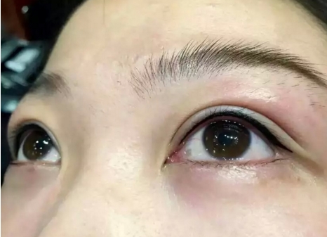 杭州藝星美容醫(yī)院：徐利剛所完成的鼻部整形效果如何？進(jìn)行人物簡(jiǎn)介以及鼻部整形手術(shù)風(fēng)格的介紹。