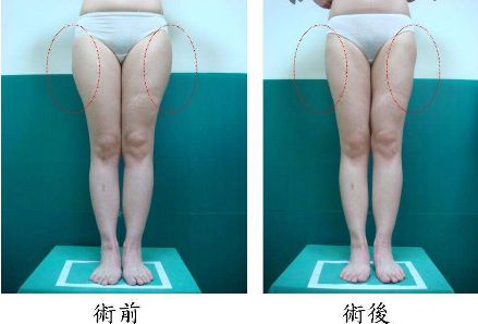 昆明哪家治痘痘好的醫(yī)院，痘痘問(wèn)題如何有效解決？