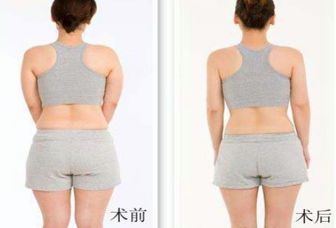 洛陽雙眼皮好的醫(yī)院有哪些？