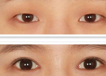 鄭州哪家美容醫(yī)院正規(guī)且口碑好？