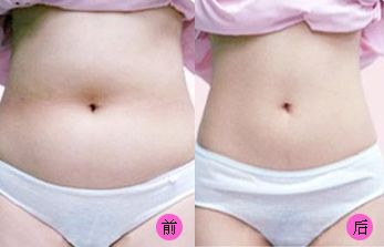 【2023吉林雙眼皮手術(shù)評測】哪家醫(yī)院值得信賴？