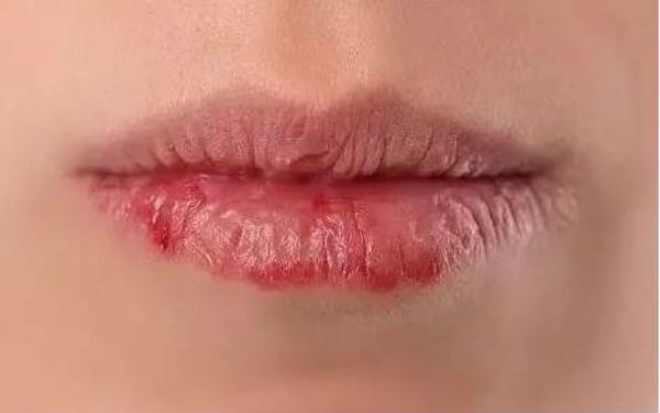 2023石家莊做眼袋手術(shù)評(píng)分十強(qiáng)醫(yī)生(王晶晶、種冬至、宋倩都是行業(yè)內(nèi)的佼佼者！)