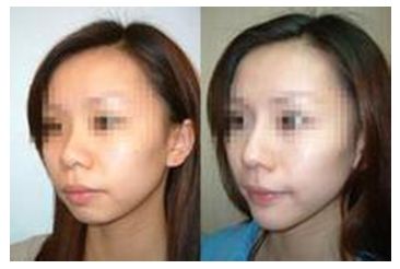 秦皇島美容美體哪家好？刷爆朋友圈的秘密美容院大揭秘！