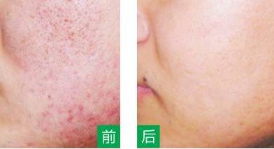 永州美辰醫(yī)療整形醫(yī)院的價(jià)格如何？收費(fèi)標(biāo)準(zhǔn)透明公開，術(shù)前注意事項(xiàng)必看！