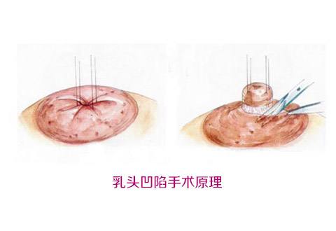 揭秘北京大學(xué)深圳醫(yī)院整形外科名醫(yī)團(tuán)隊(duì)！想了解吸脂案例嗎？來(lái)看這里！