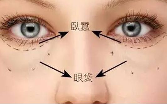 海口哪家醫(yī)院做眼袋效果好？