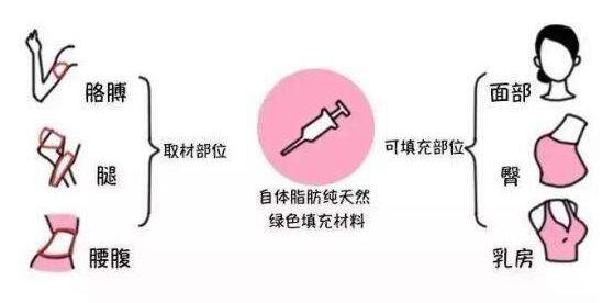 成都潘紅偉吸脂手術(shù)效果如何？專家解讀！