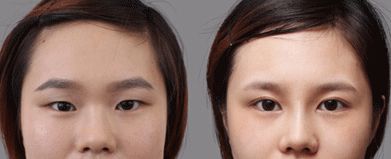 合肥哪家處女膜修復(fù)醫(yī)院靠譜又專業(yè)？