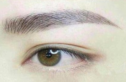 北京柏麗整形雙眼皮手術費用及成功案例回顧