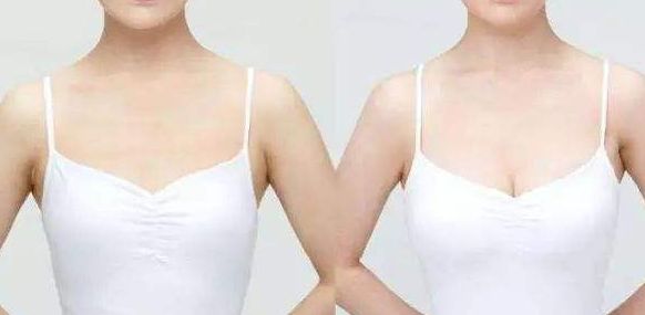 威海假體豐胸醫(yī)院哪家好？從專家口碑、手術(shù)效果看威海頂級醫(yī)院推薦！