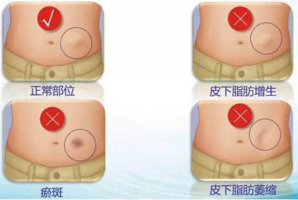哈爾濱整形醫(yī)院哪家好？選擇哈爾濱整容醫(yī)院前必知的五大關(guān)鍵點(diǎn)