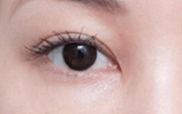 廣州哪家醫(yī)院做隆胸手術(shù)技術(shù)高？醫(yī)生資深經(jīng)驗(yàn)來看詳細(xì)介紹！