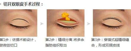淮安光子嫩膚醫(yī)院哪家好？專家為您推薦5家權(quán)威醫(yī)院