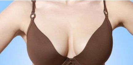合肥藝星做美杜莎雙眼皮的價格是多少？