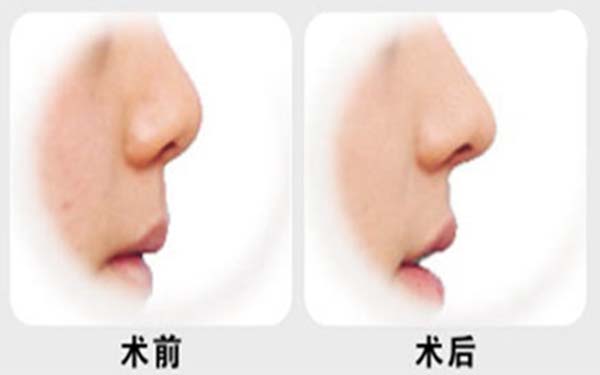 上海專業(yè)唇部整形五大口碑專家公布，人氣名醫(yī)張余光、周佳、戴傳昌等榜上有名