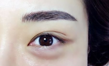 銀川有哪些專業(yè)的激光祛痘印醫(yī)院值得推薦？