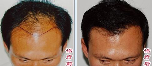 榆林醫(yī)專附屬醫(yī)院醫(yī)學整形美容中心怎么樣？榆林醫(yī)專附屬醫(yī)院醫(yī)學整形美容中心簡介|醫(yī)生團隊|口碑評價！