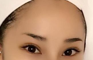 合肥哪家醫(yī)院臉部激光治療效果好，值得推薦？