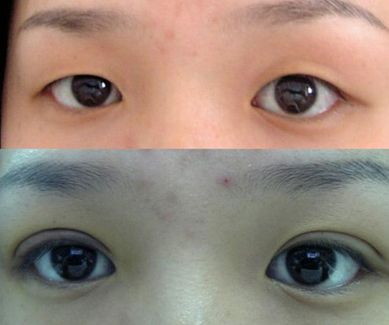 濟(jì)南哪家整形醫(yī)院的拉皮效果好且價(jià)格合適？