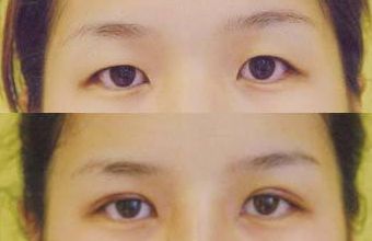 大慶微整形醫(yī)院哪家好？頂級(jí)專家為您解讀微整形醫(yī)院選擇指南！