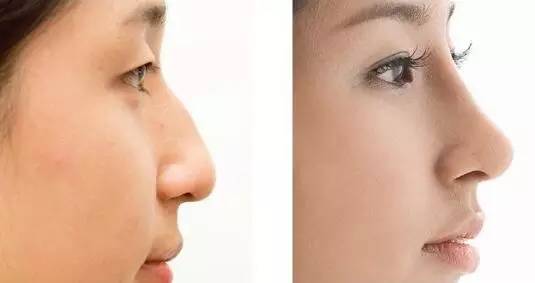 2023深圳瘦大腿吸脂術(shù)醫(yī)生榜單top10強(羅雄鵬、江虹、何安平這些醫(yī)生值得推薦)