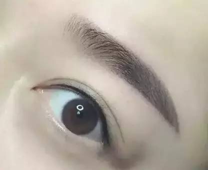 佰華利董萍的面部脂肪填充經驗，展現自然少女感