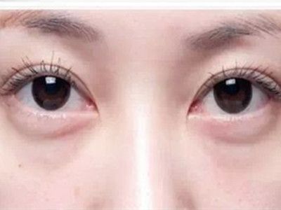 寧波祛斑哪家醫(yī)院好？精選寧波祛斑專業(yè)醫(yī)院推薦！