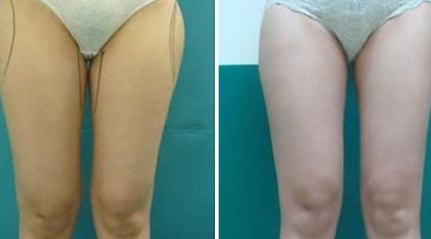 揭陽激光美容醫(yī)院哪家好？選擇揭陽最佳激光美容醫(yī)院的7個關(guān)鍵要素！