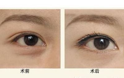 寧波隆鼻Top5醫(yī)生：技術精湛，聲譽卓越，口碑贊不絕口！