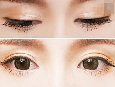 西寧豐胸整形醫(yī)院排名前三，專業(yè)醫(yī)生推薦！