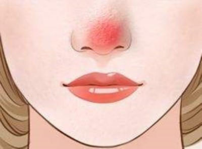 上海九院哪位醫(yī)生做雙眼皮技術(shù)好？價格如何？附帶成功案例分析