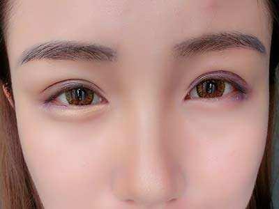2023合肥魚尾紋專家評(píng)價(jià)TOP10強(qiáng)(羅定安、劉家賀、朱凡口碑價(jià)格出爐)