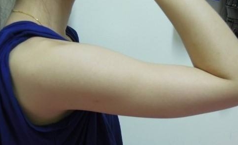 趙寅局拉皮：口碑何如？經(jīng)歷、擅長(zhǎng)和用戶反饋來(lái)說話！